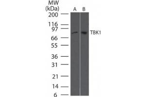 TBK1 NAK Western Blot.