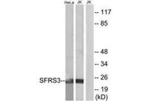 Western blot analysis of extracts from HeLa/Jurkat cells, using SFRS3 Antibody. (SRSF3 anticorps  (AA 111-160))