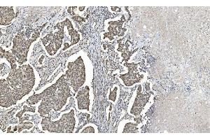 IHC analysis of HDAC5 using anti-HDAC5 antibody (ABIN7599922). (HDAC5 anticorps  (AA 13-1107))