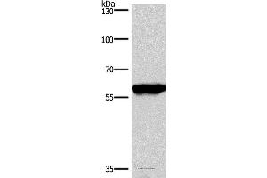 Western blot analysis of Mouse brain tissue, using PPP3CA Polyclonal Antibody at dilution of 1:900 (PPP3CA anticorps)