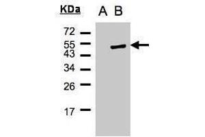 WB Image Western Blot analysis of PSCD1 expression in transfected 293T cell line by PSCD1 polyclonal antibody. (Cytohesin 1 anticorps)