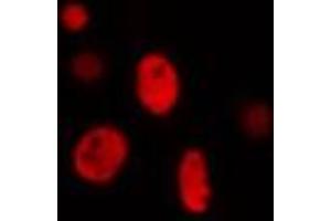 ABIN6274282 staining Hela cells by IF/ICC. (ZNF134 anticorps)