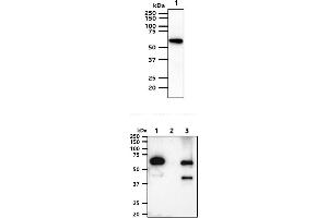 The cell lysates (40ug) were resolved by SDS-PAGE, transferred to PVDF membrane and probed with anti-human AKT1/3 antibody (1:1000). (AKT1/3 anticorps)