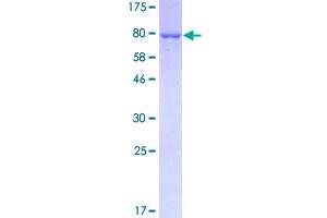 Image no. 1 for Alanine Aminotransferase (ALT) (AA 1-496) protein (GST tag) (ABIN1355674)
