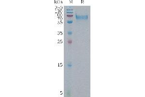 Human IBSP Protein, His Tag on SDS-PAGE under reducing condition.