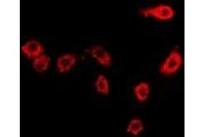Immunofluorescent analysis of Moesin staining in Hela cells.