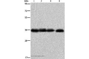 Western blot analysis of K562 cell and  human kidney cancer tissue, 293T and HepG2 cell, using F11R Polyclonal Antibody at dilution of 1:600 (F11R anticorps)