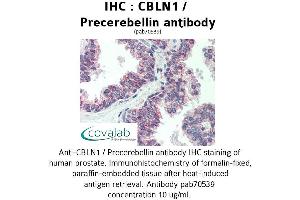 Image no. 1 for anti-Cerebellin 1 Precursor (CBLN1) antibody (ABIN1732717) (CBLN1 anticorps)