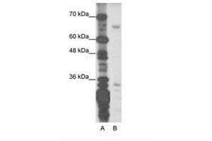Image no. 1 for anti-Zinc Finger Protein 691 (ZNF691) (N-Term) antibody (ABIN202159)