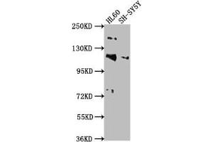 Western Blot Positive WB detected in: HL60 whole cell lysate, SH-SY5Y whole cell lysate All lanes: RAPGEF1 antibody at 1:2000 Secondary Goat polyclonal to rabbit IgG at 1/50000 dilution Predicted band size: 121, 117, 123 kDa Observed band size: 121 kDa