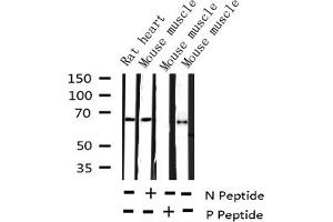 Western blot analysis of Phospho-AFX (Ser197) expression in various lysates