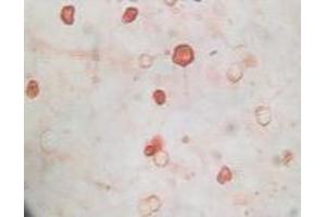 Immunohistochemistry (IHC) image for anti-KSHVK8a antibody (ABIN2464074) (KSHVK8a anticorps)