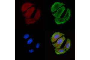 ABIN6258526 and ABIN6274768 staining Hela cells(30 min of UV treatment) by IF/ICC. (RPL12 anticorps  (C-Term))
