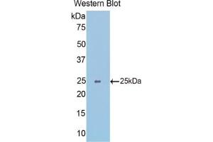 Western blot analysis of the recombinant protein. (SLIT1 anticorps  (AA 3-211))