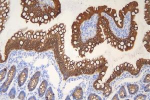 IHC analysis of Krt20 using anti-Krt20 antibody (ABIN7601133). (KRT20 anticorps  (AA 29-431))