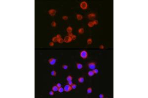Immunofluorescence analysis of Neuro-2a cells using [KO Validated] CD171/L1CAM Rabbit pAb (ABIN6131538, ABIN6143053, ABIN6143054 and ABIN7101826) at dilution of 1:150 (40x lens).