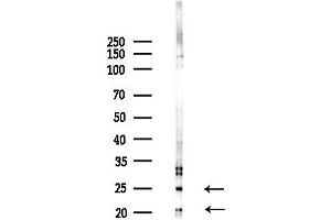 anti-Tumor Suppressor Candidate 5 (TUSC5) (N-Term) antibody