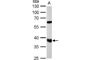 WB Image FDPS antibody detects FDPS protein by Western blot analysis.