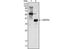 Western blot analysis using MATK antibody against K562 cell lysate (1).
