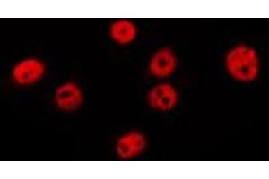 ABIN6275067 staining MCF7 by IF/ICC.