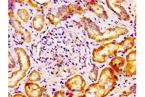 anti-V-Set Domain Containing T Cell Activation Inhibitor 1 (VTCN1) (AA 26-258) antibody