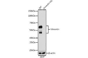 Western blot analysis of extracts from wild type (WT) and Vimentin knockout (KO) 293T cells, using Vimentin antibody (ABIN7271326) at 1:1000 dilution. (Vimentin anticorps)