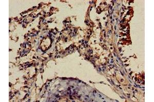 Immunohistochemistry of paraffin-embedded human lung tissue using ABIN7174020 at dilution of 1:100