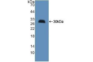 Detection of Recombinant HMGCS, Mouse using Polyclonal Antibody to Hydroxymethylglutaryl Coenzyme A Synthase (HMGCS) (HMGCS1 anticorps  (AA 1-238))