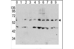Western blot analysis of phospho c-Myc antibody and human TPA activated HeLa cells/lysate (0: without TPA (c-MYC anticorps  (pThr58))