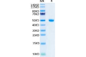 Human NGAL/Lipocalin-2 on Tris-Bis PAGE under reduced condition.