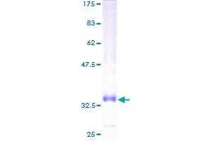 Chemokine (C-C Motif) Ligand 14 (CCL14) (AA 20-93) protein (GST tag)