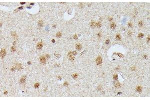 Immunohistochemistry of paraffin-embedded Rat brain using IGHMBP2 Polyclonal Antibody at dilution of 1:100 (40x lens).