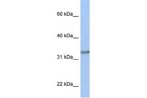 Western Blotting (WB) image for anti-Acyl-CoA Binding Domain Containing 4 (ACBD4) antibody (ABIN2459338) (ACBD4 anticorps)