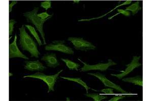 Immunofluorescence of monoclonal antibody to NDN on HeLa cell.