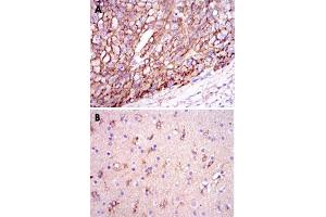 Immunohistochemical analysis of paraffin-embedded human liver cancer tissues (A) and brain tissues (B) using APOE monoclonal antibody, clone 1H4  with DAB staining. (APOE anticorps)