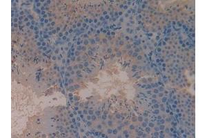 Detection of C4 in Mouse Testis Tissue using Polyclonal Antibody to Complement Component 4 (C4)