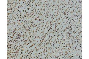 IHC analysis of RPA32/RPA2 using anti-RPA32/RPA2 antibody (ABIN7601379). (RPA2 anticorps  (AA 34-254))
