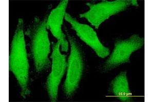 Immunofluorescence of purified MaxPab antibody to C9orf6 on HeLa cell.