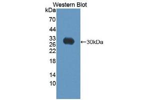 Figure. (ABCC10 anticorps  (AA 1246-1492))