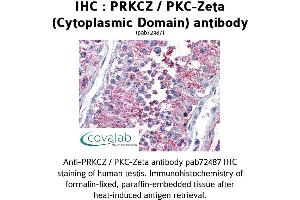 Image no. 2 for anti-Protein Kinase C, zeta (PRKCZ) (1st Cytoplasmic Domain) antibody (ABIN1738343) (PKC zeta anticorps  (1st Cytoplasmic Domain))