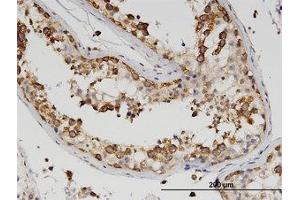 Image no. 2 for anti-Z-DNA Binding Protein 1 (ZBP1) (AA 2-101) antibody (ABIN599594) (ZBP1 anticorps  (AA 2-101))