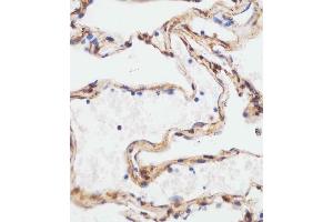 B staining TUBA4A in human lung tissue sections by Immunohistochemistry (IHC-P - paraformaldehyde-fixed, paraffin-embedded sections). (TUBA4A anticorps  (C-Term))
