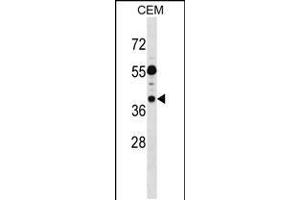 Western blot analysis in CEM cell line lysates (35ug/lane). (TSSC1 anticorps  (C-Term))