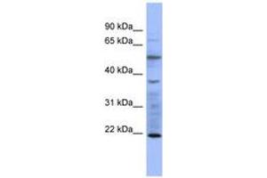 Image no. 1 for anti-Myosin, Light Chain 3 (MYL3) (AA 35-84) antibody (ABIN6741643) (MYL3/CMLC1 anticorps  (AA 35-84))