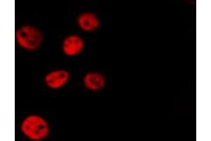 ABIN6267699 staining Hela by IF/ICC.