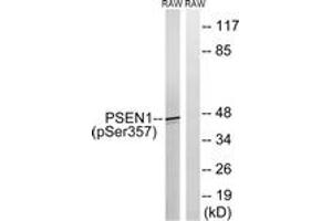 Western blot analysis of extracts from RAW264. (Presenilin 1 anticorps  (pSer357))