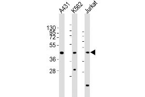 All lanes : Anti-RBMX Antibody (Center) at 1:2000 dilution Lane 1: A431 whole cell lysates Lane 2: K562 whole cell lysates Lane 3: Jurkat whole cell lysates Lysates/proteins at 20 μg per lane. (RBMX anticorps  (AA 222-252))