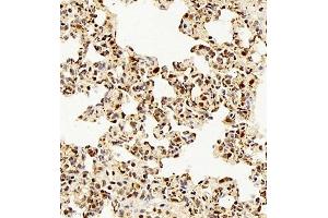Immunohistochemistry of paraffin embedded rat lung using rap1 (ABIN7075857) at dilution of 1: 2000 (400x lens)