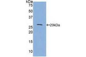 Western blot analysis of recombinant Mouse CD1d. (CD1d anticorps  (AA 56-271))