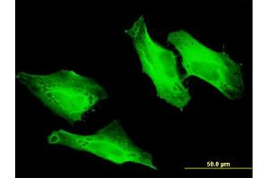 Immunofluorescence of monoclonal antibody to CEP57 on HeLa cell .